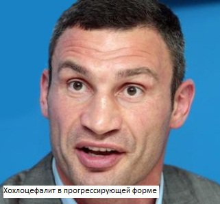 Украиноз — чума XXI века Украиноз — чума XXI века