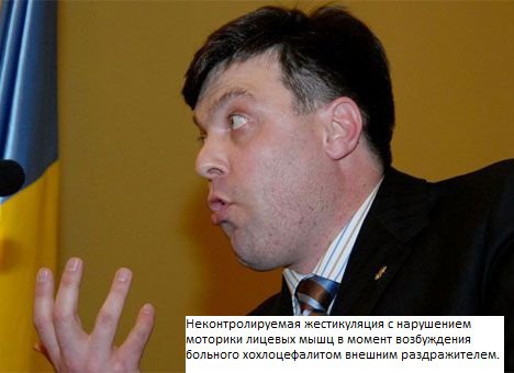 Украиноз — чума XXI века Украиноз — чума XXI века