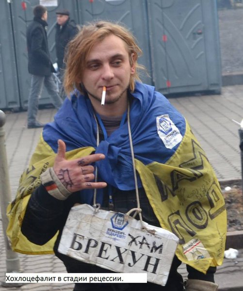 Украиноз — чума XXI века Украиноз — чума XXI века