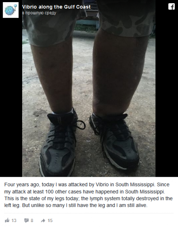 После разлива нефти BP жителям США угрожает смертельная бактерия (ФОТО) | Русская весна