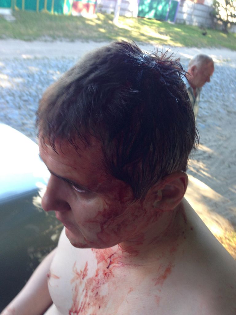 В Чернигове неонацисты избили волынского коммуниста Михаила Кононовича