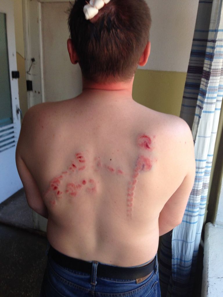 В Чернигове неонацисты избили волынского коммуниста Михаила Кононовича